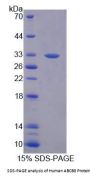 Human ATP Binding Cassette Transporter B8 (ABCB8) Protein