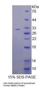 Human Bile Salt Export Pump (ABCB11) Protein