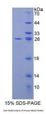 Mouse ATP Binding Cassette Transporter D2 (ABCD2) Protein
