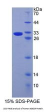 Human ATP Binding Cassette Transporter D4 (ABCD4) Protein