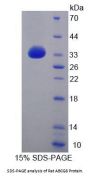Rat ATP Binding Cassette Subfamily G Member 8 (ABCG8) Protein