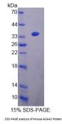 Mouse 3-Ketoacyl-CoA Thiolase, Mitochondrial (ACAA2) Protein
