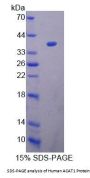 Human Acetyl Coenzyme A Acetyltransferase 1 (ACAT1) Protein
