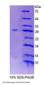 Rat Acyl Coenzyme A Oxidase 2, Branched (ACOX2) Protein