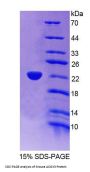 Mouse Acyl Coenzyme A Oxidase 3, Pristanoyl (ACOX3) Protein