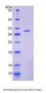 Human Acyl Coenzyme A Synthetase Medium Chain Family, Member 1 (ACSM1) Protein