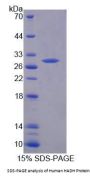 Human Hydroxyacyl Coenzyme A Dehydrogenase (HADH) Protein