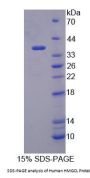 Human 3-Hydroxymethyl-3-Methylglutaryl Coenzyme A Lyase (HMGCL) Protein