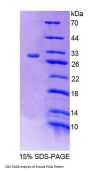 Mouse Propionyl Coenzyme A Carboxylase Beta (PCCb) Protein