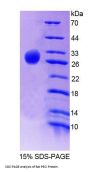 Rat Peroxisomal D3, D2-Enoyl Coenzyme A Isomerase (PECI) Protein