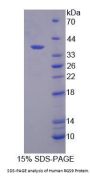 Human Regulator Of G Protein Signaling 9 (RGS9) Protein