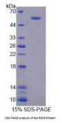 Rat Regulator Of G Protein Signaling 6 (RGS6) Protein