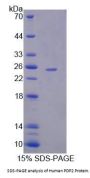 Human Pyruvate Dehydrogenase Phosphatase 2 (PDP2) Protein