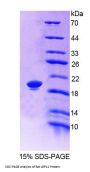 Rat Low Density Lipoprotein Receptor Related Protein 11 (LRP11) Protein