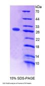 Human Putative Alpha-1-Antitrypsin-Related Protein (SERPINA2) Protein