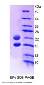 Human Arginine Vasopressin-Induced Protein 1 (AVPI1) Protein