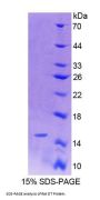 Rat Preprooxytocin (OT) Protein