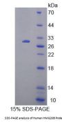 Human SWI/SNF-Related Matrix-Associated Actin-Dependent Regulator of Chromatin Subfamily E Member 1-Related (HMG20B) Protein