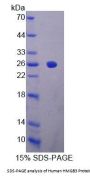 Human High Mobility Group Protein B3 (HMGB3) Protein