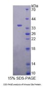 Mouse Complement Component 8a (C8a) Protein