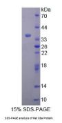 Rat Complement Component 8a (C8a) Protein
