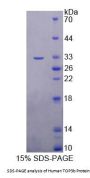 Human Topoisomerase III Beta (TOP3b) Protein