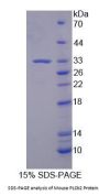 Mouse Phospholipase C Beta 2 (PLCb2) Protein