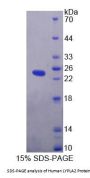 Human Lysophospholipase II (LYPLA2) Protein