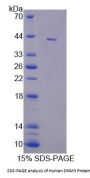 Human Dynamin 3 (DNM3) Protein