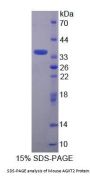 Mouse Alanine Glyoxylate Aminotransferase 2 (AGXT2) Protein