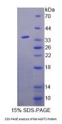 Rat Alanine Glyoxylate Aminotransferase 2 (AGXT2) Protein