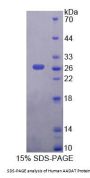 Human Aminoadipate Aminotransferase (AADAT) Protein