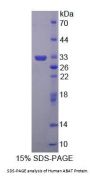 Human 4-Aminobutyrate Aminotransferase (ABAT) Protein