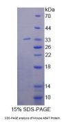 Mouse 4-Aminobutyrate Aminotransferase (ABAT) Protein