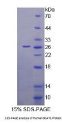 Human Branched Chain Aminotransferase 1, Cytosolic (BCAT1) Protein