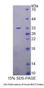 Human Branched Chain Aminotransferase 2, Mitochondrial (BCAT2) Protein