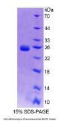 Rat Branched Chain Aminotransferase 2, Mitochondrial (BCAT2) Protein