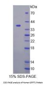Human Glutamine Fructose-6-Phosphate Transaminase 1 (GFPT1) Protein