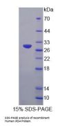 Human Insulin Receptor Substrate 4 (IRS4) Protein