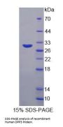 Human Dipeptidyl Peptidase 3 (DPP3) Protein