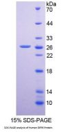 Human Dipeptidyl Peptidase 6 (DPP6) Protein