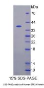 Human General Transcription Factor IIIA (GTF3A) Protein