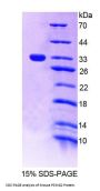 Mouse Proteasome Assembly Chaperone 2 (PSMG2) Protein