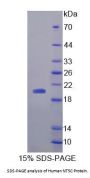 Human 5',3'-Nucleotidase, Cytosolic (NT5C) Protein