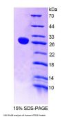 Human Cytosolic Purine 5'-Nucleotidase (NT5C2) Protein