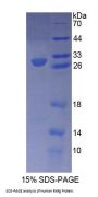 Human Retinoid X Receptor Gamma (RXRg) Protein
