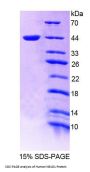 Human Nuclear Receptor Subfamily 1, Group D, Member 1 (NR1D1) Protein
