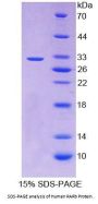 Human Retinoic Acid Receptor Beta (RARb) Protein