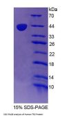 Human Testicular Receptor 2 (TR2) Protein