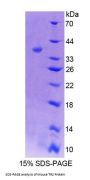 Mouse Testicular Receptor 2 (TR2) Protein